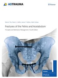 Cover Fractures of the Pelvis and Acetabulum / AO Trauma