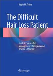 Cover The Difficult Hair Loss Patient