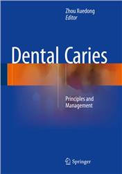 Cover Dental Caries