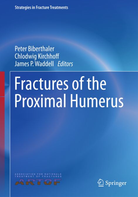 Fractures of the Proximal Humerus