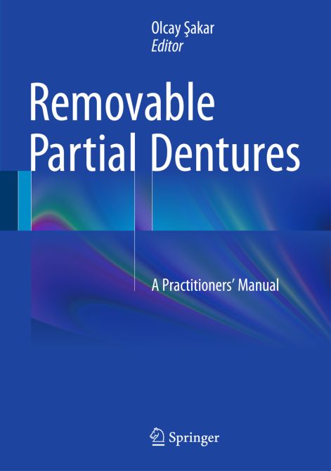 Removable Partial Dentures