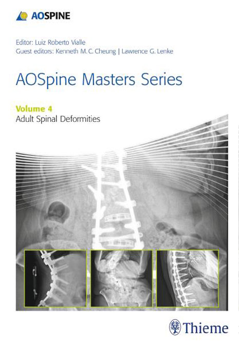 AO Spine Masters Series