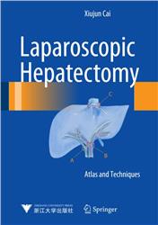 Cover Laparoscopic Hepatectomy