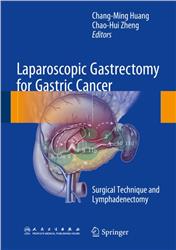 Cover Laparoscopic Gastrectomy for Gastric Cancer