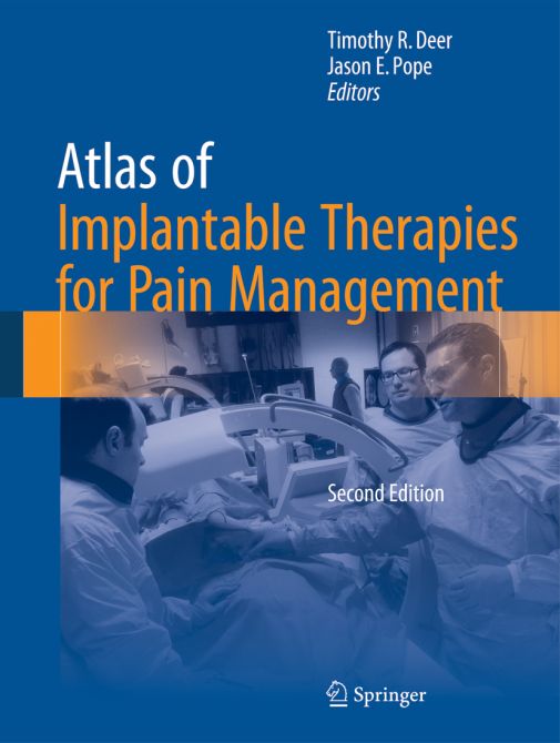 Atlas of Implantable Therapies for Pain Management