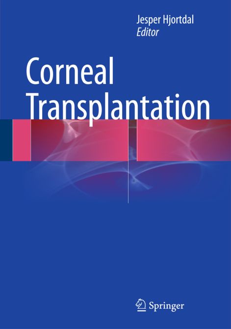 Corneal Transplantation