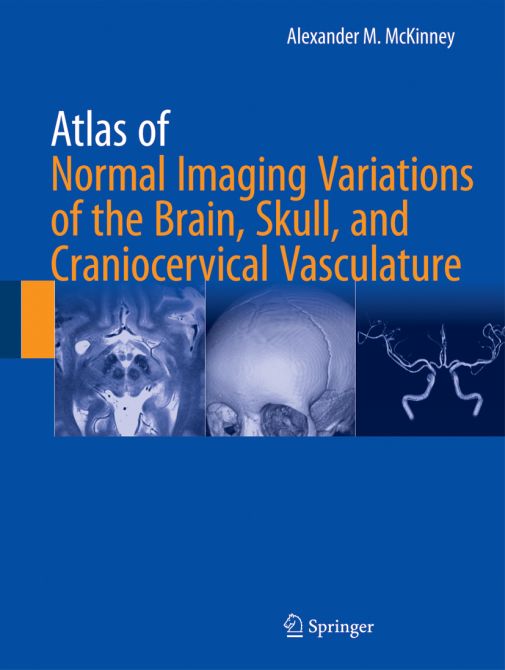 Atlas of Normal Imaging Variations of the Brain, Skull, and Craniocervical Vasculature - 2 Volumes -