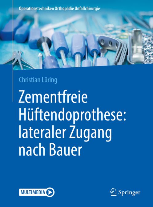 Zementfreie Hüftendoprothese: lateraler Zugang nach Bauer