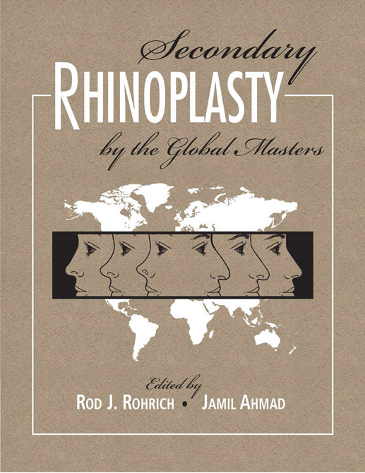 Secondary Rhinoplasty