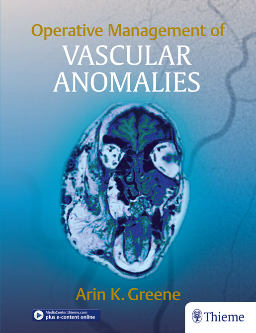 Operative Management of Vascular Anomalies