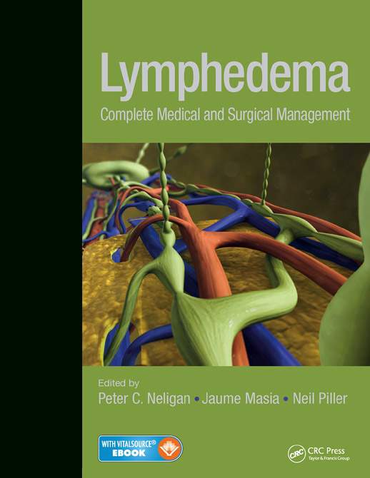 Lymphedema