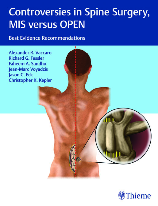 Controversies in Spine Surgery: MIS versus OPEN