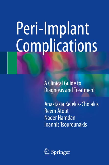 Peri-Implant Complications