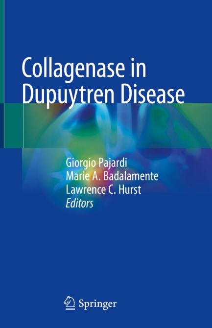 Collagenase in Dupuytren Disease