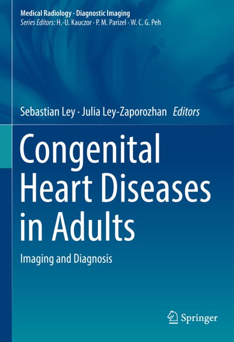 Congenital Heart Diseases in Adults