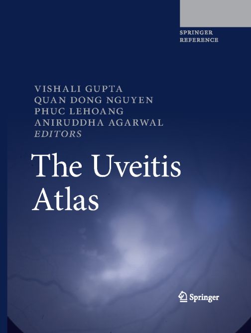 The Uveitis Atlas