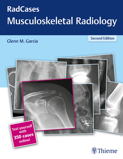 Radcases Musculoskeletal Radiology