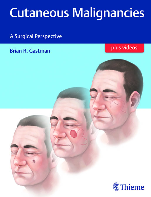 Cutaneous Malignancies