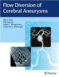 Cover Flow Diversion of Cerebral Aneurysms