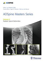 Cover AOSpine Masters Series, Volume 9: Pediatric Spinal Deformities