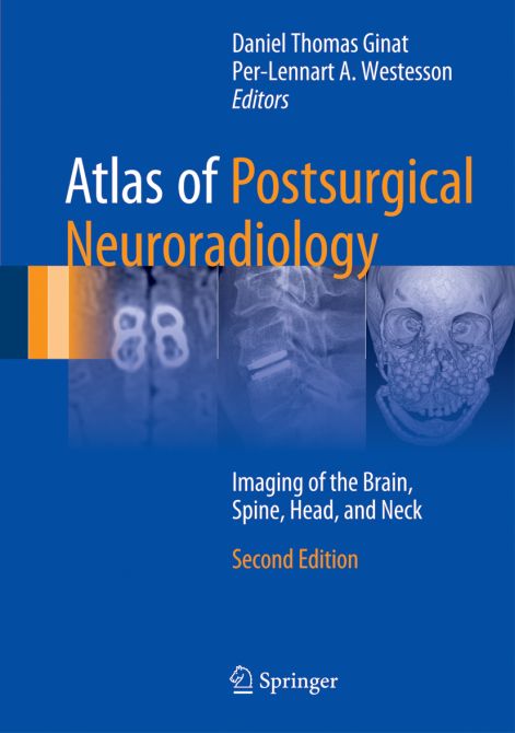 Atlas of Postsurgical Neuroradiology