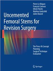 Cover Uncemented Femoral Stems for Revision Surgery