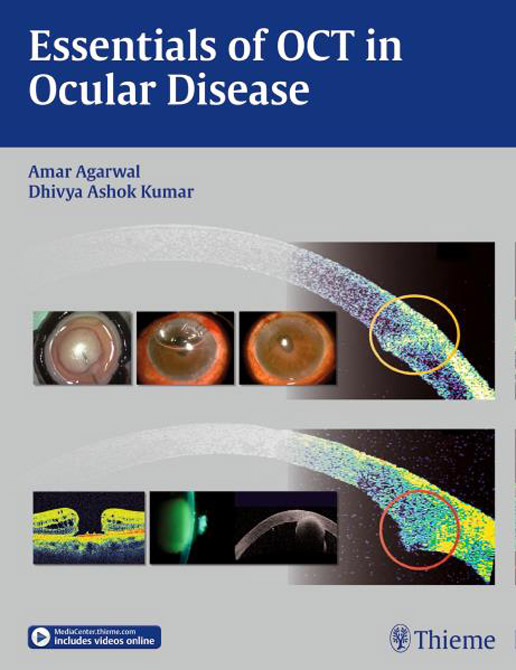 Essentials of OCT in Ocular Disease