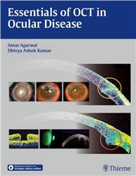 Cover Essentials of OCT in Ocular Disease