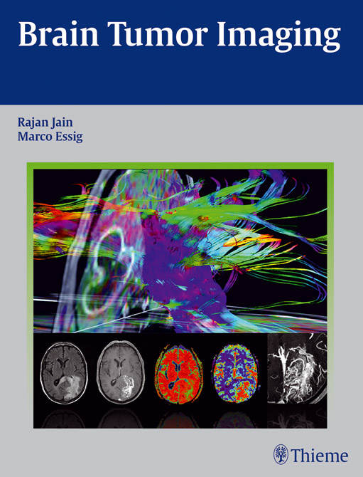 Brain Tumor Imaging