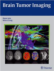 Cover Brain Tumor Imaging