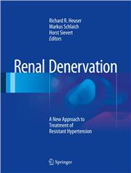 Cover Renal Denervation