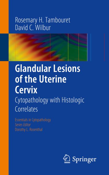 Glandular Lesions of the Uterine Cervix