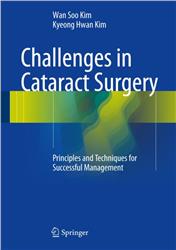 Cover Challenges in Cataract Surgery