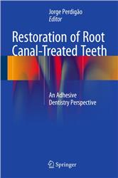 Cover Restoration of Root Canal-Treated Teeth