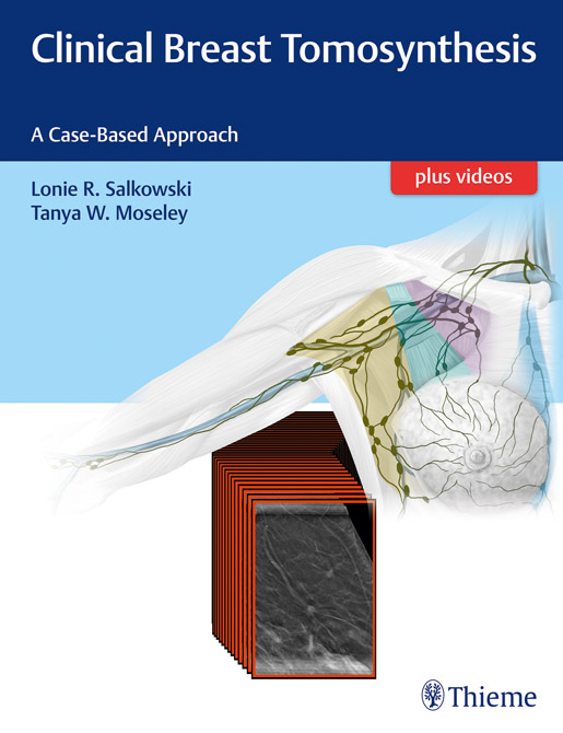 Clinical Breast Tomosynthesis