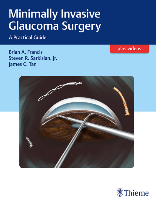 Minimally Invasive Glaucoma Surgery