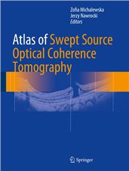 Cover Atlas of Swept-Source Optical Coherence Tomography