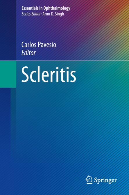 Scleritis