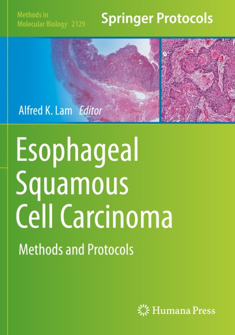 Esophageal Squamous Cell Carcinoma: Methods and Protocols