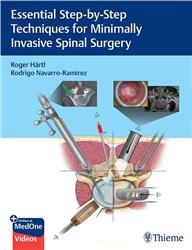 Cover Essential Step-by-Step Techniques for Minimally Invasive Spine Surgery