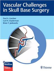 Cover Vascular Challenges in Skull Base Surgery