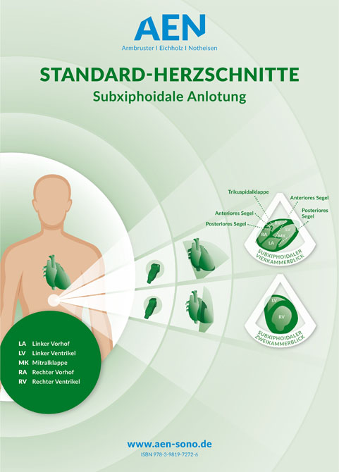 Standard-Herzschnitte Echokardiografie / Poster