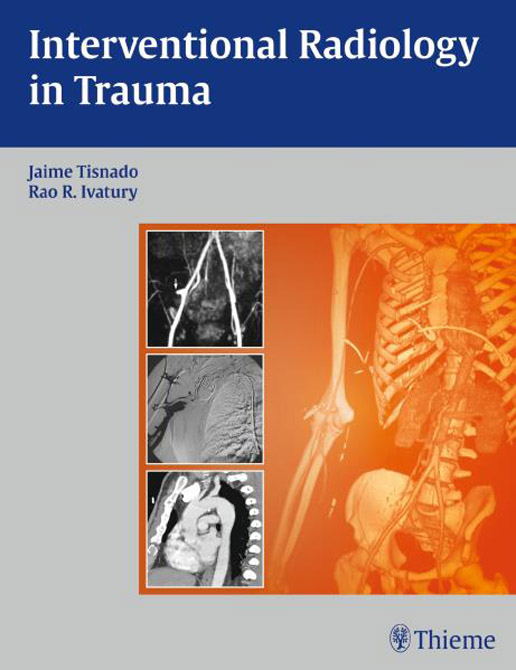 Interventional Radiology in Trauma Management