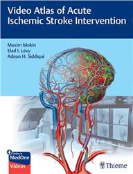 Cover Video Atlas of Acute Ischemic Stroke Intervention