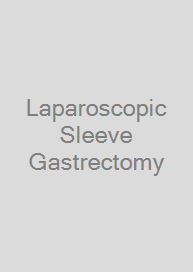 Laparoscopic Sleeve Gastrectomy