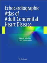 Cover Echocardiographic Atlas of Adult Congenital Heart Disease