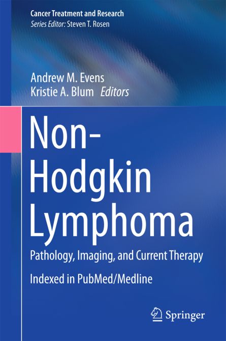 Non-Hodgkin Lymphoma