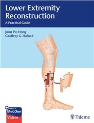 Cover Lower Extremity Reconstruction