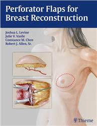 Cover Perforator Flaps for Breast Reconstruction