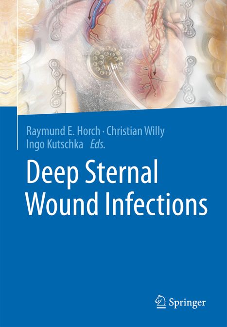 Deep Sternal Wound Infections